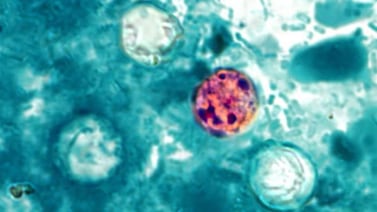 Cyclospora: The surprisingly long list of what scientists can’t explain about how it contaminates food