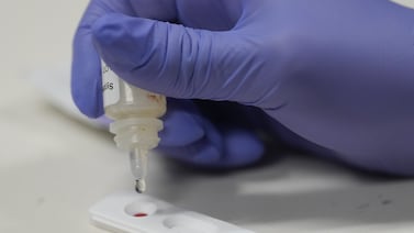 Resurgence of congenital syphilis signals ‘urgent need’ for testing, treatment