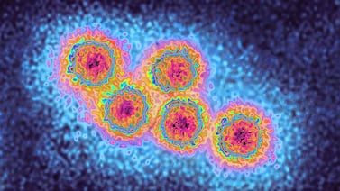 NYC Health Department warns of hepatitis A case at Manhattan restaurant