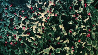 Why mpox is persisting around the world