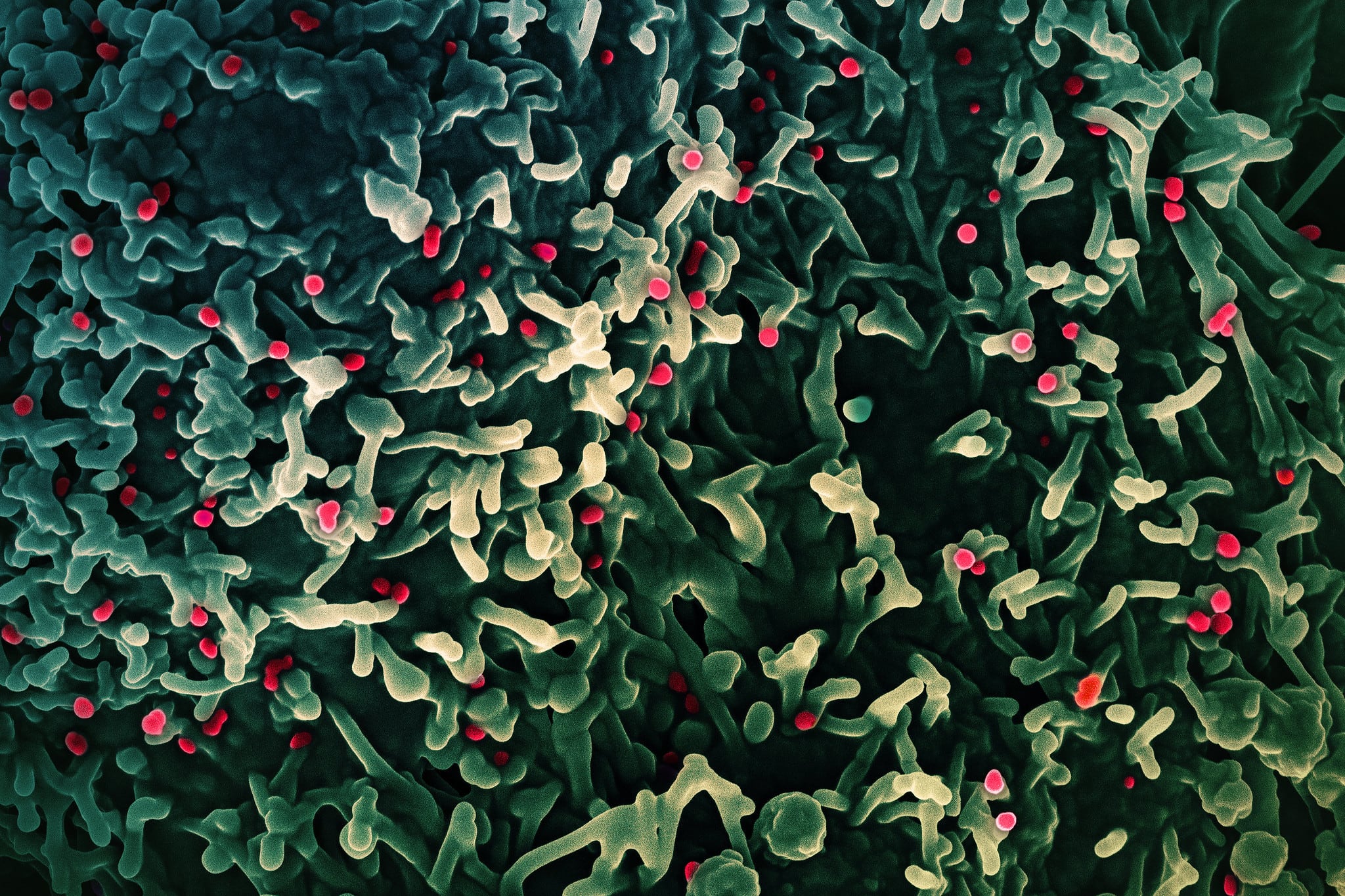 A colorized scanning electron micrograph of mpox virus.