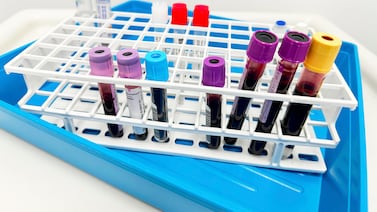 Exclusive: As measles outbreaks spread, older adults seek immunity tests at sharply higher rates