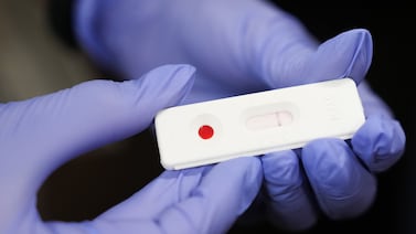 Are STIs truly declining, or is our data just lacking? What the 2024 CDC report really shows