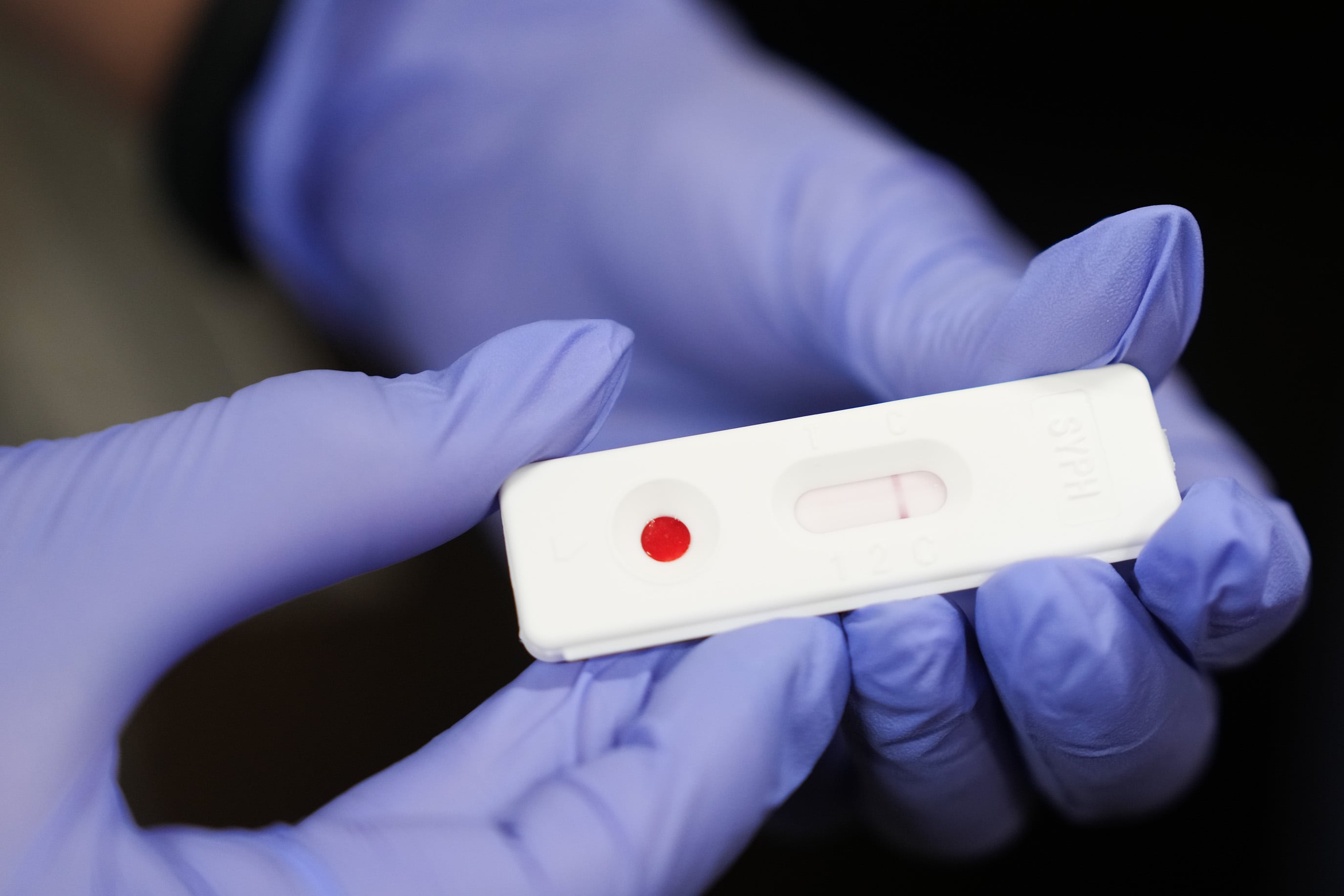 Two gloved hands hold a test showing a negative result for congenital syphilis.