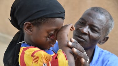 A new discovery could help end disfigurement of ‘very poorest children’