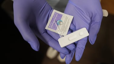 New York state reports 3 infant deaths as congenital syphilis cases keep rising