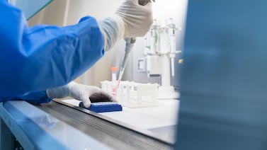 Trump administration is ending multiple HIV vaccine studies, scientists and officials say