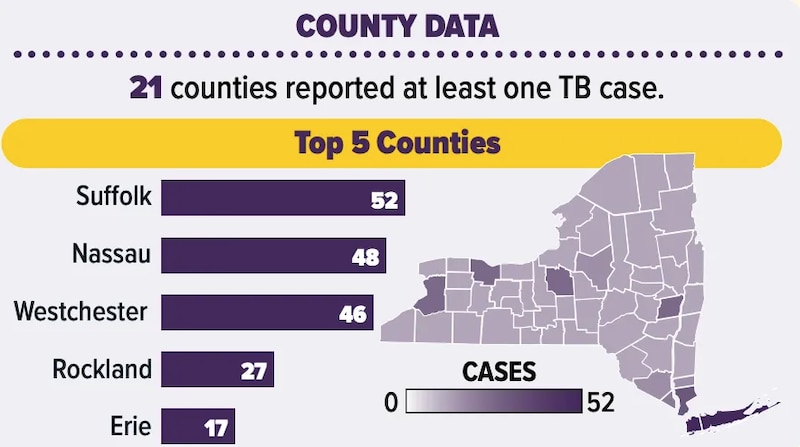 A graphic shows 2024 tuberculosis cases in New York counties.