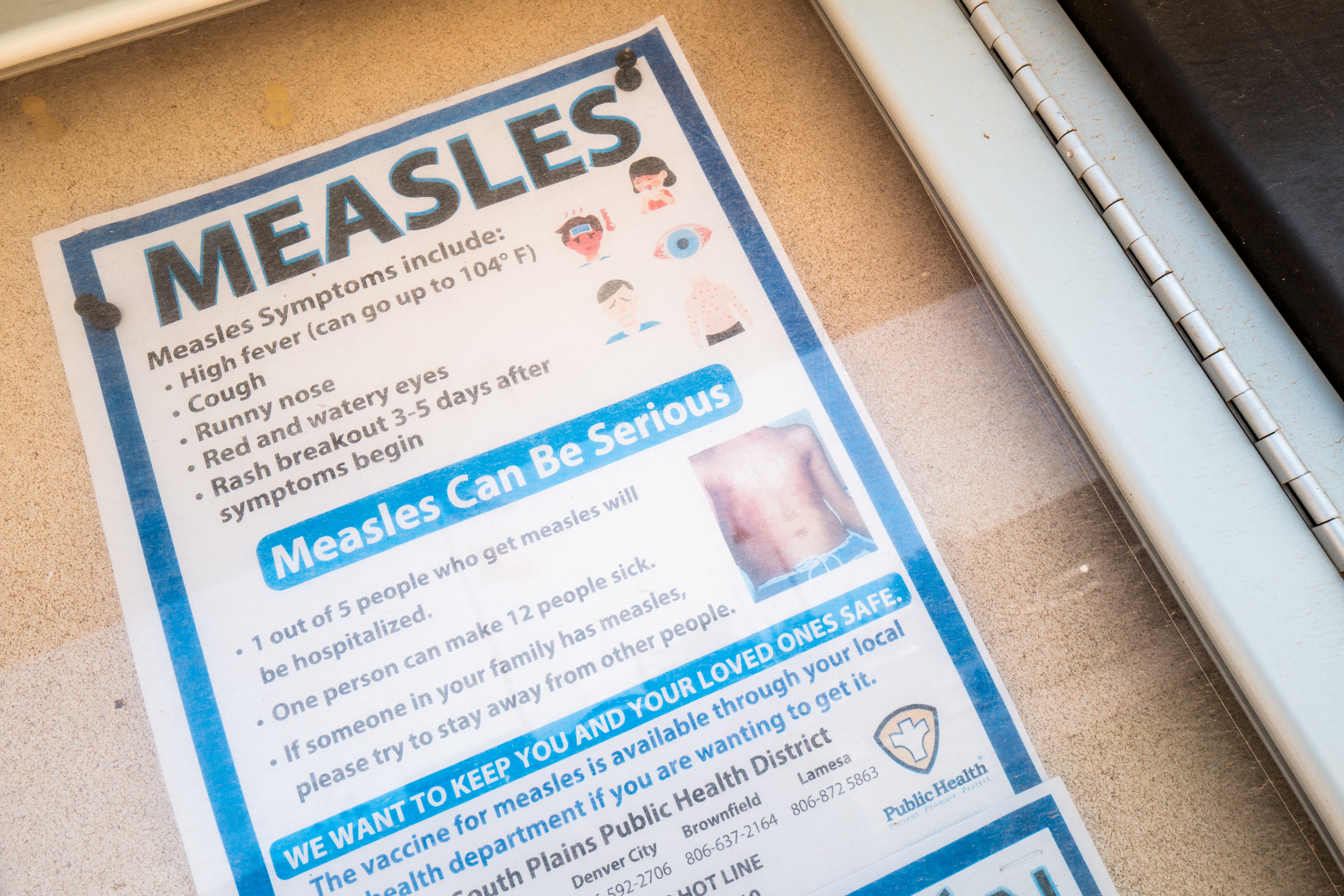 A measles advisory is shown tacked to a bulletin board outside a buildling.