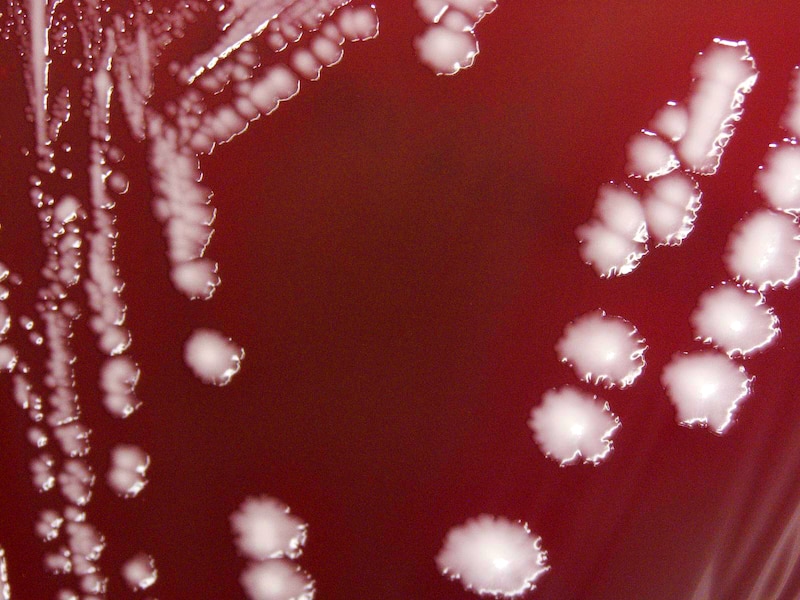 White bacteria seen on a red background - this is under a microscope.